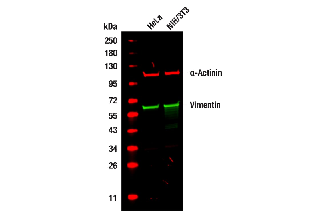 Western Blotting Image 1: Vimentin (D21H3) Rabbit Monoclonal Antibody