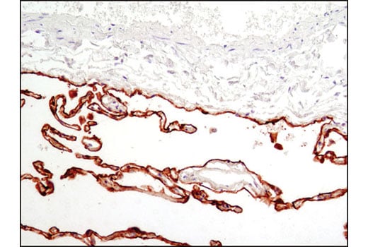 Immunohistochemistry Image 1: RAGE 1 Antibody
