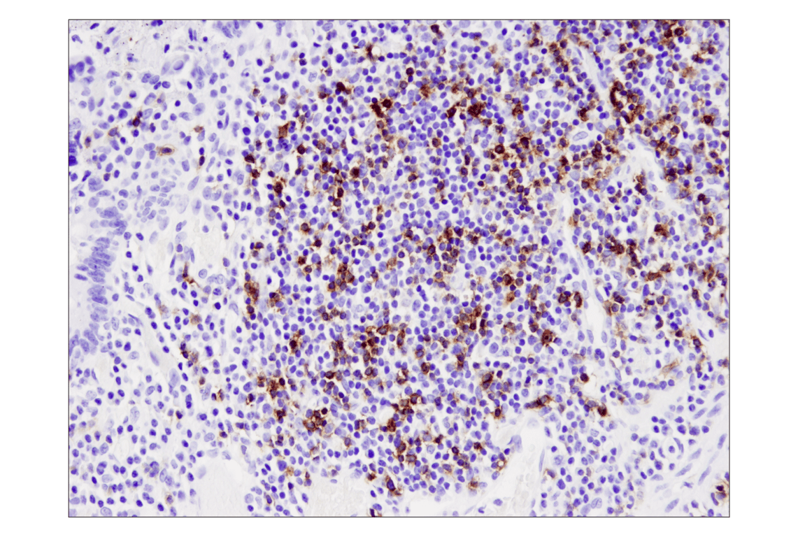 Immunohistochemistry Image 1: PD-1 (EH33) Mouse Monoclonal Antibody