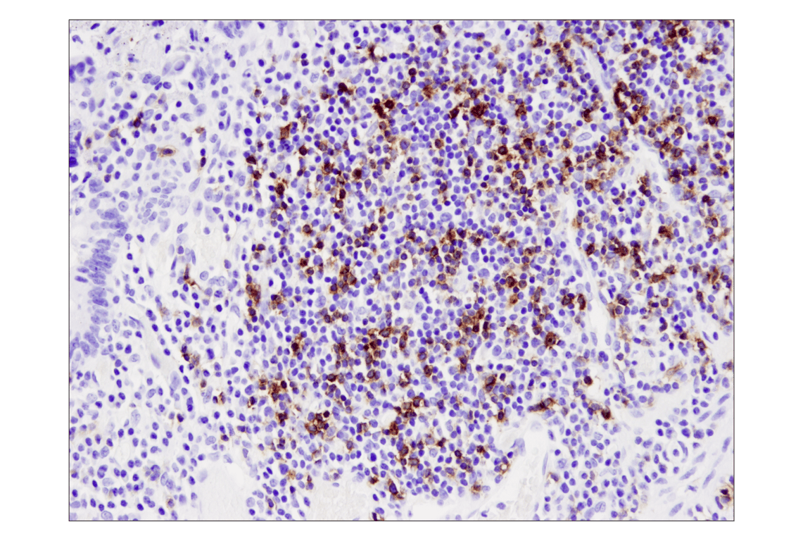 Immunohistochemistry Image 1: PD-1 (EH33) Mouse mAb