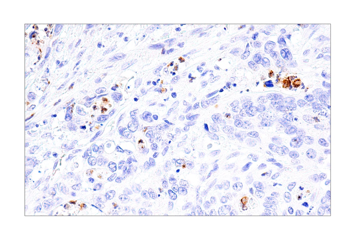 Immunohistochemistry Image 3: IL-8 (E5F5Q) Rabbit Monoclonal Antibody