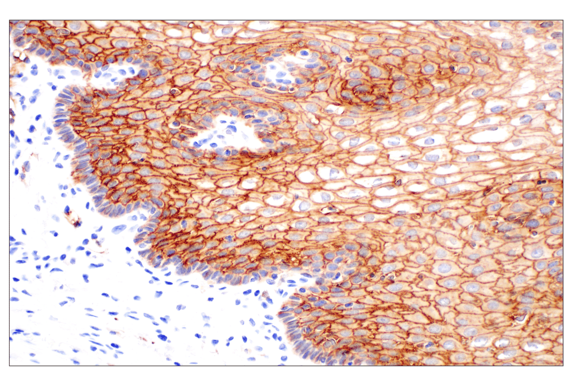 Immunohistochemistry Image 6: TACSTD2/TROP2 (F4W4J) Rabbit Monoclonal Antibody