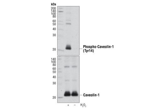 undefined Image 2: Vesicle Trafficking Antibody Sampler Kit