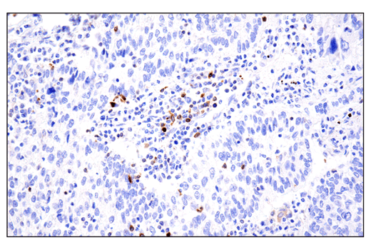 Immunohistochemistry Image 5: Phospho-SLP-76 (Ser376) (E3G9U) Rabbit Monoclonal Antibody (BSA and Azide Free)