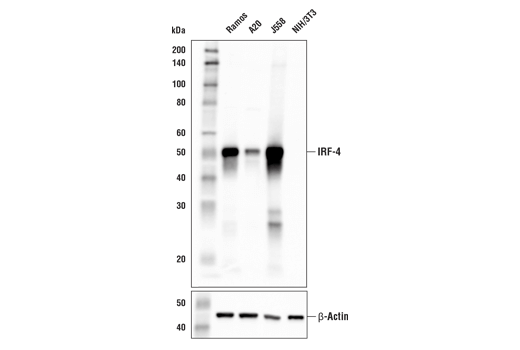 Western Blotting Image 2: IRF-4 (E8H3S) XP<sup>®</sup> Rabbit mAb