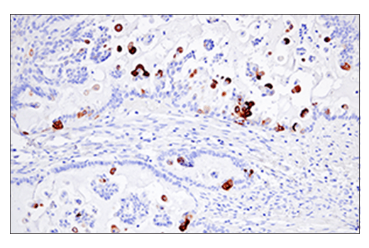 Immunohistochemistry Image 3: Keratin 5 (E2T4B) Rabbit Monoclonal Antibody (BSA and Azide Free)
