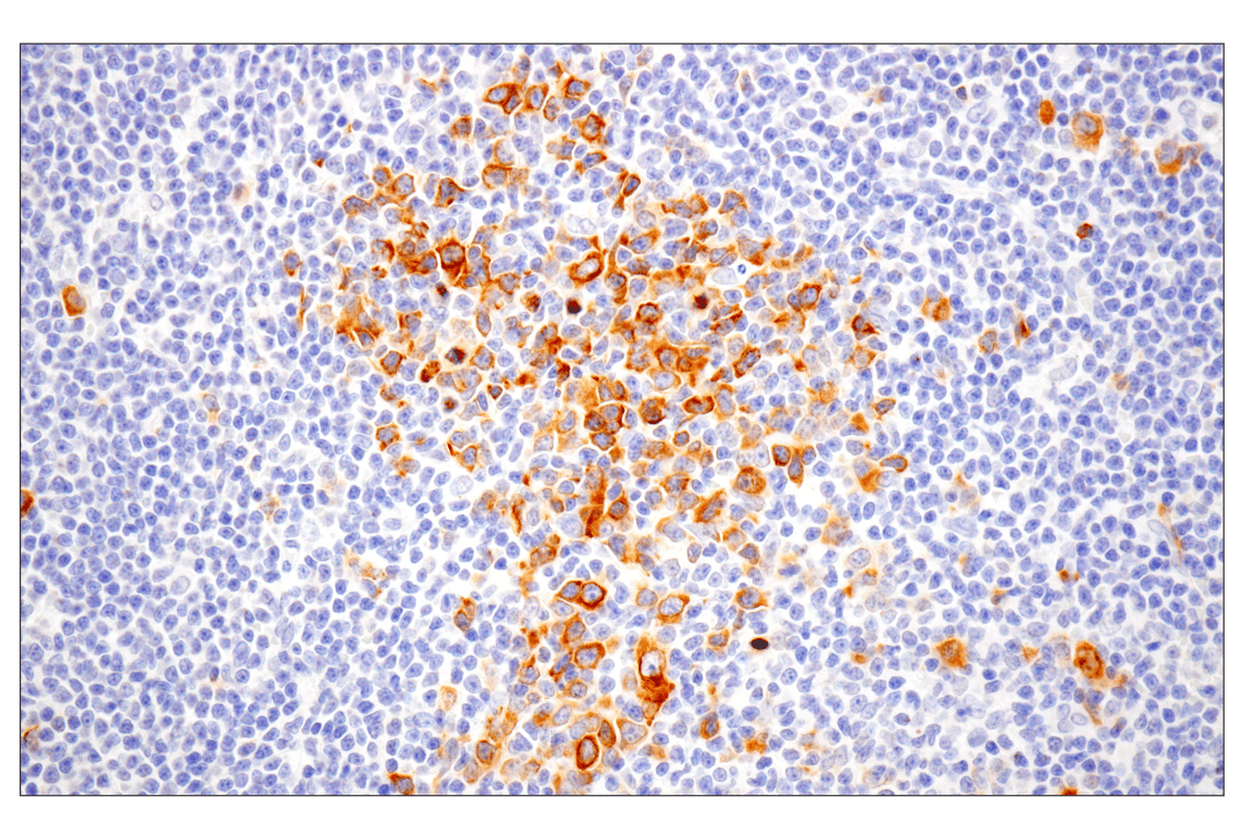 Immunohistochemistry Image 1: Eg5 (E1L3W) Rabbit Monoclonal Antibody