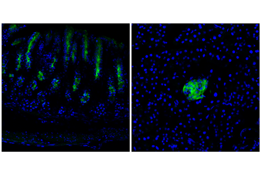 Immunofluorescence Image 1: BACE2 (E3Y9Q) Rabbit Monoclonal Antibody