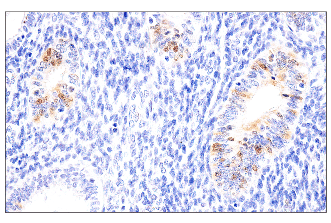 undefined Image 31: Phospho-Chk1/2 Antibody Sampler Kit