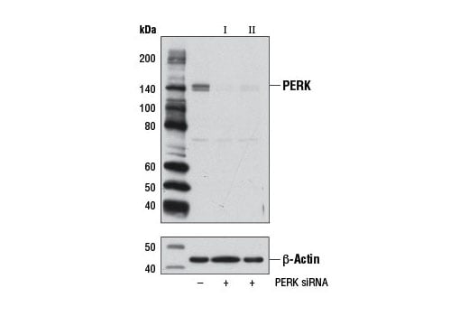 undefined Image 1: SignalSilence<sup>®</sup> PERK siRNA I