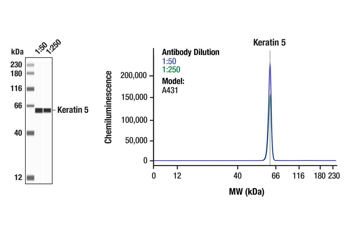 Western Blotting Image 1: Keratin 5 (E2T4B) Rabbit Monoclonal Antibody