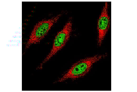 Immunofluorescence Image 1: Tri-Methyl-Histone H3 (Lys36) (D5A7) Rabbit Monoclonal Antibody