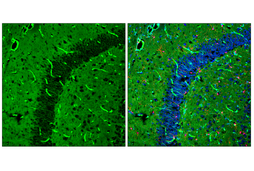 Immunofluorescence Image 1: Glut1 (E4S6I) Rabbit Monoclonal Antibody