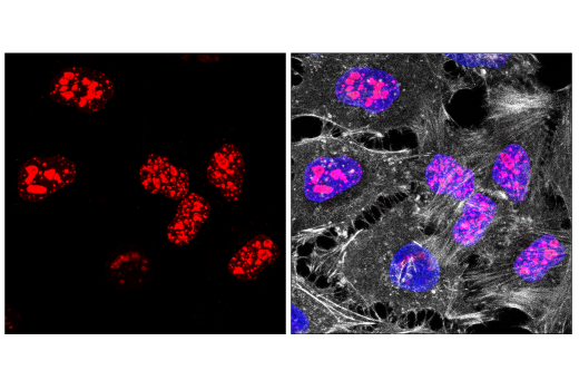 Immunofluorescence Image 1: Ki-67 (D3B5) Rabbit Monoclonal Antibody (Alexa Fluor<sup>®</sup> 555 Conjugate)