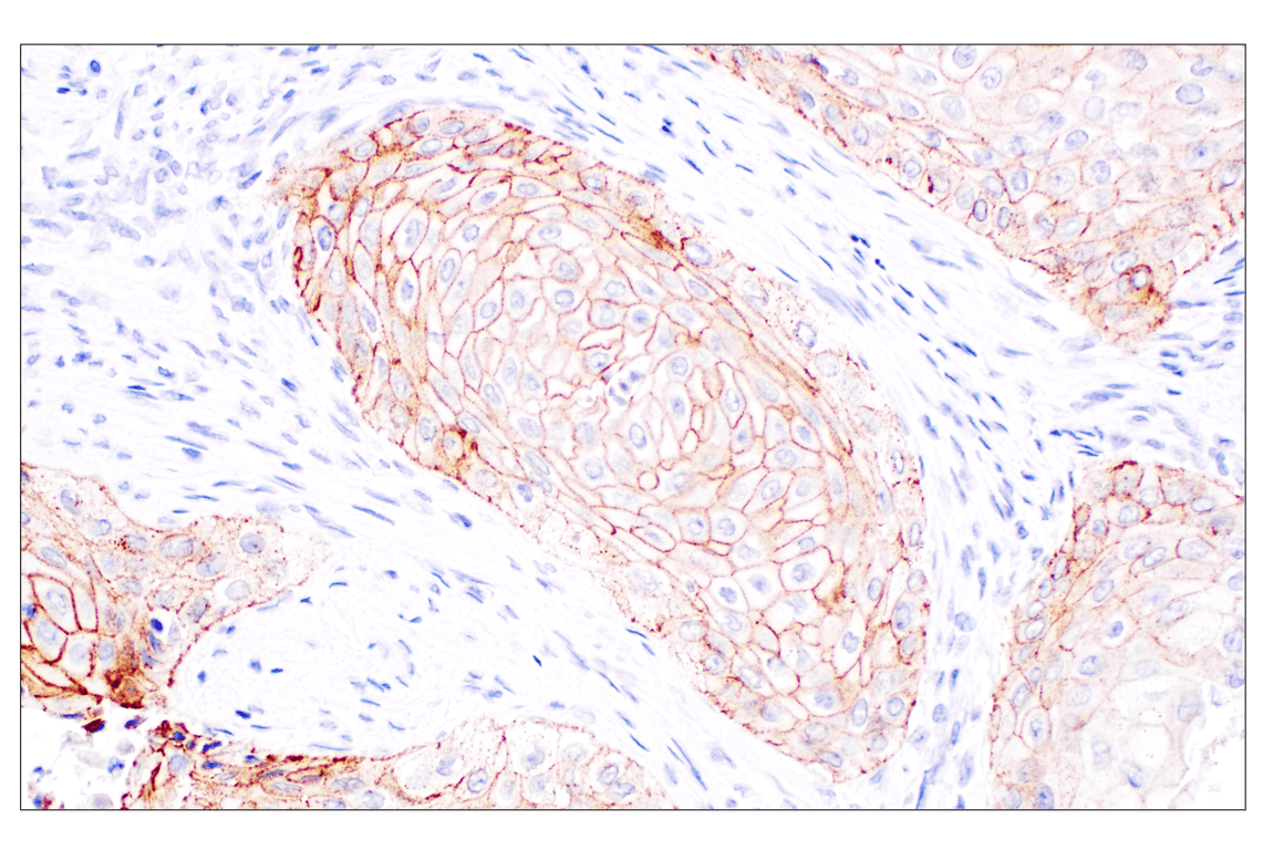 undefined Image 21: Cadherin-Catenin Antibody Sampler Kit