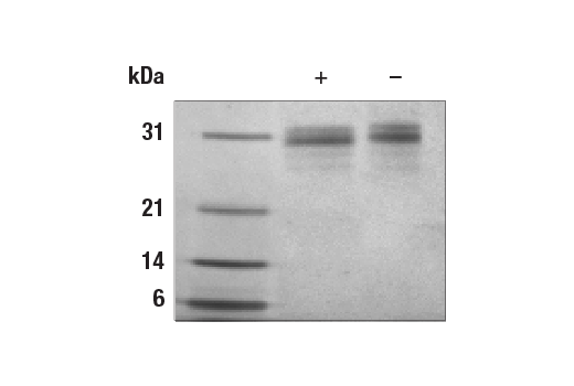undefined Image 2: Human FGF-5 Recombinant Protein