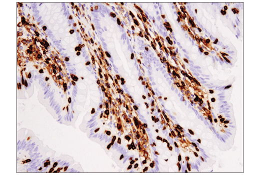 Immunohistochemistry Image 1: Coronin 1A (D6K5B) XP<sup>®</sup> Rabbit mAb