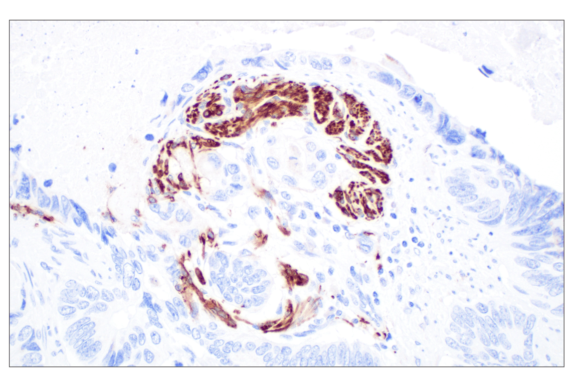 Immunohistochemistry Image 1: GAP43 (E6L2W) Mouse Monoclonal Antibody