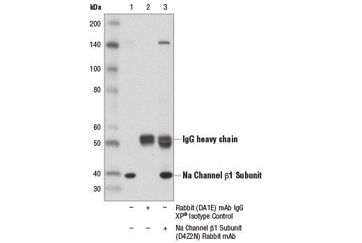 Immunoprecipitation Image 1: Na Channel beta1 Subunit (D4Z2N) Rabbit Monoclonal Antibody