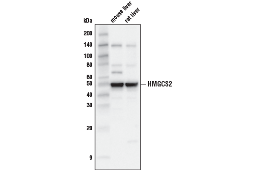 Western Blotting Image 2: HMGCS2 (D8B5M) Rabbit Monoclonal Antibody