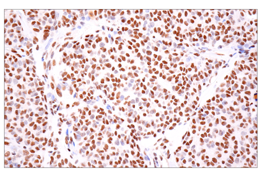 Immunohistochemistry Image 10: TDP43 (E2G6G) Rabbit Monoclonal Antibody (BSA and Azide Free)