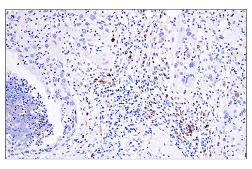 Immunohistochemistry Image 3: Cleaved Gasdermin D (Asp275) (E7H9G) Rabbit Monoclonal Antibody