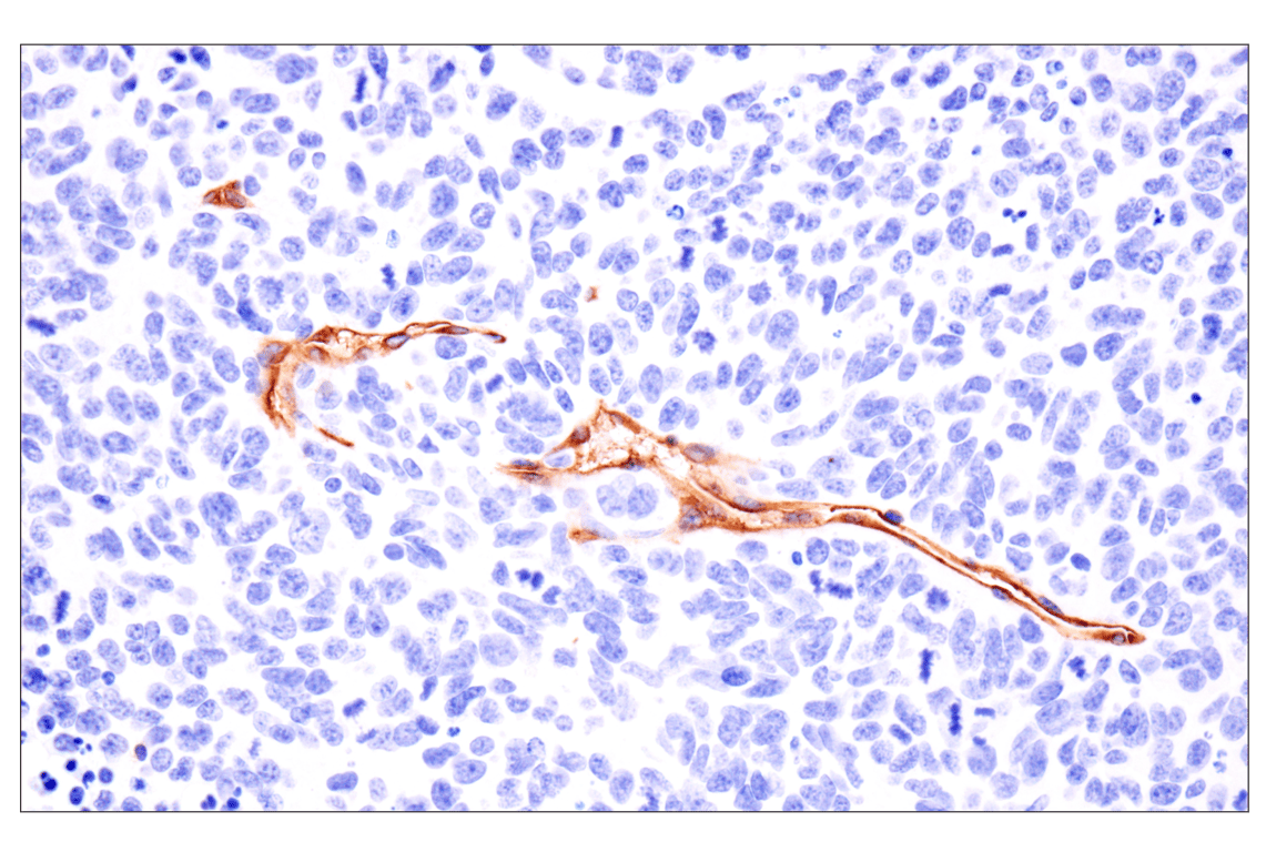 Immunohistochemistry Image 2: ESAM (F9D9P) Rabbit Monoclonal Antibody