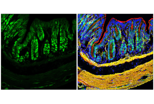 Immunofluorescence Image 1: NDRG1 (E2T5I) Rabbit Monoclonal Antibody