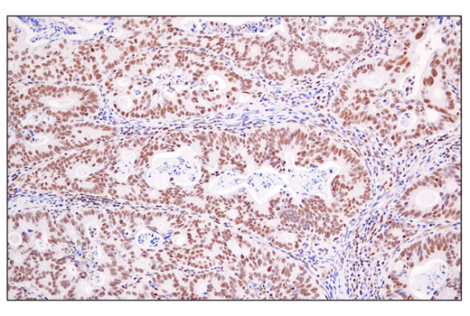 Immunohistochemistry Image 1: DEK (E4S5J) Rabbit Monoclonal Antibody
