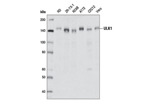 undefined Image 13: Autophagy Induction (ULK1 Complex) Antibody Sampler Kit