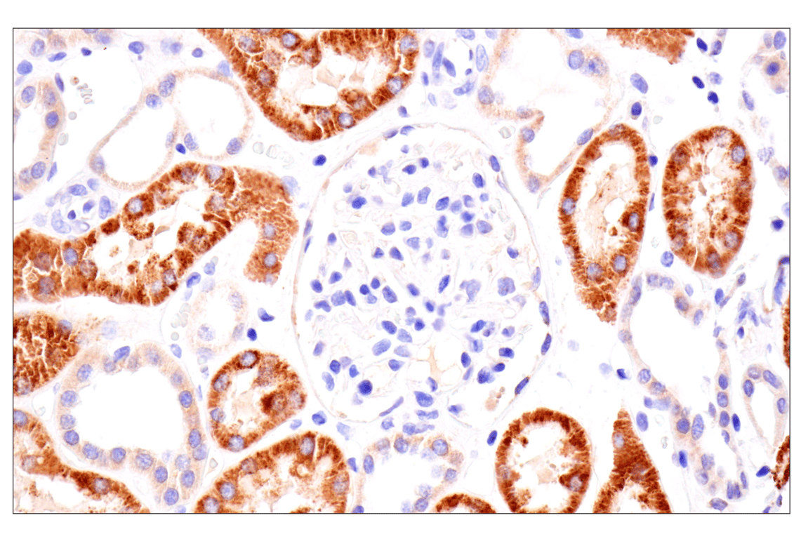Immunohistochemistry Image 8: AMACR (F7T6V) Rabbit mAb
