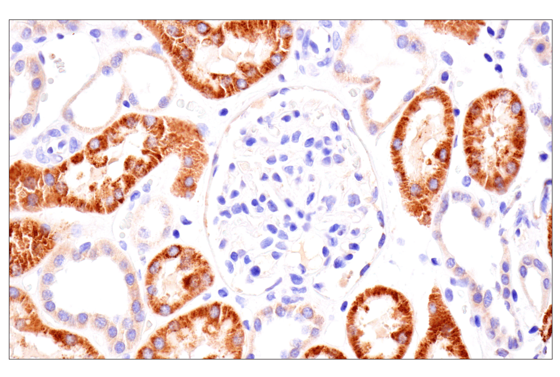 Immunohistochemistry Image 8: AMACR (F7T6V) Rabbit Monoclonal Antibody