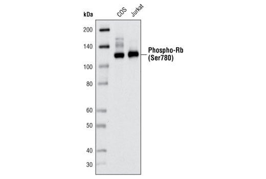 Western Blotting Image 2: Phospho-Rb (Ser780) (C84F6) Rabbit Monoclonal Antibody
