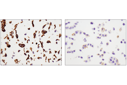 Immunohistochemistry Image 4: Tissue Factor/CD142 (E9M6T) Rabbit Monoclonal Antibody (BSA and Azide Free)