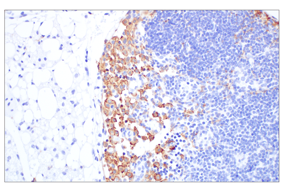 Immunohistochemistry Image 3: Siglec-1/CD169 (E1D7G) Rabbit Monoclonal Antibody (BSA and Azide Free)