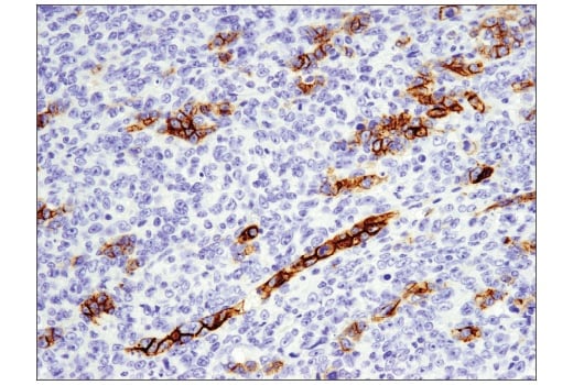 Immunohistochemistry Image 2: EpCAM (E6V8Y) Rabbit Monoclonal Antibody (BSA and Azide Free)