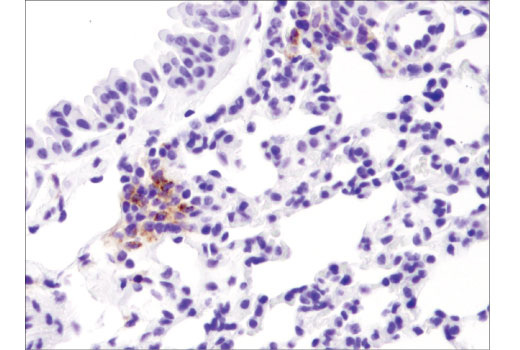 Immunohistochemistry Image 2: PD-L1 (D5V3B) Rabbit Monoclonal Antibody