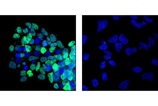 Immunofluorescence Image 1: Blimp-1/PRDI-BF1 (C14A4) Rabbit Monoclonal Antibody
