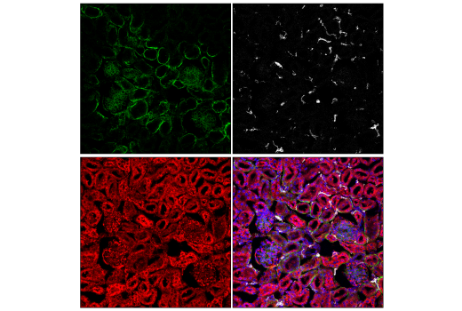 Immunofluorescence Image 2: Phospho-Paxillin (Tyr118) (E9U9F) Rabbit Monoclonal Antibody