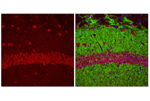 Immunofluorescence Image 2: SUMO-1 Antibody