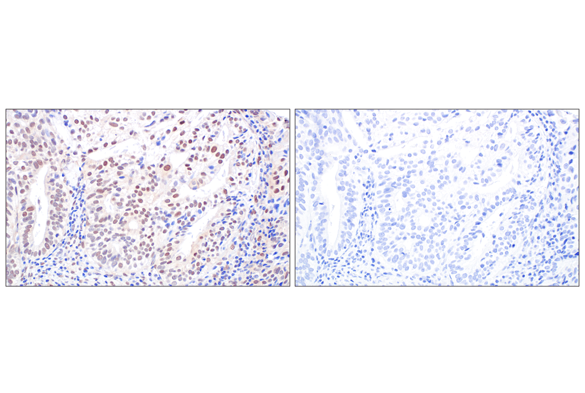 Immunohistochemistry Image 13: TFE3 (F3Z2Q) Rabbit Monoclonal Antibody