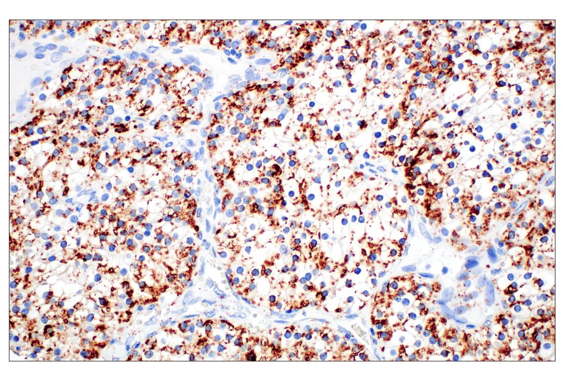 Immunohistochemistry Image 4: Perilipin-2 (E6G6M) Rabbit Monoclonal Antibody