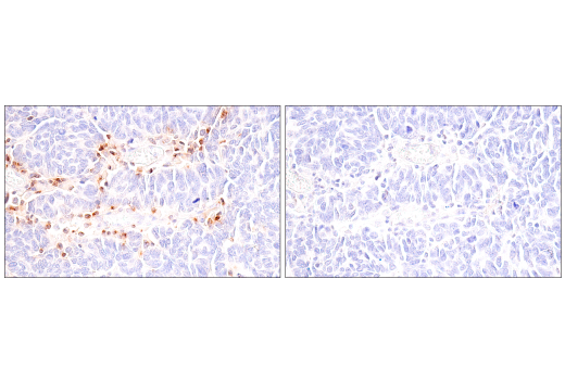 Immunohistochemistry Image 6: CCL5/RANTES (E9S2K) Rabbit Monoclonal Antibody (BSA and Azide Free)