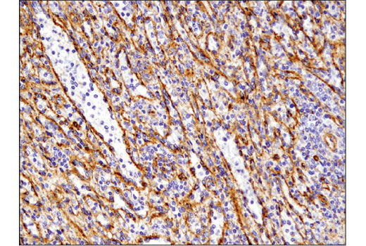 Immunohistochemistry Image 4: IFITM3 (D8E8G) Rabbit Monoclonal Antibody