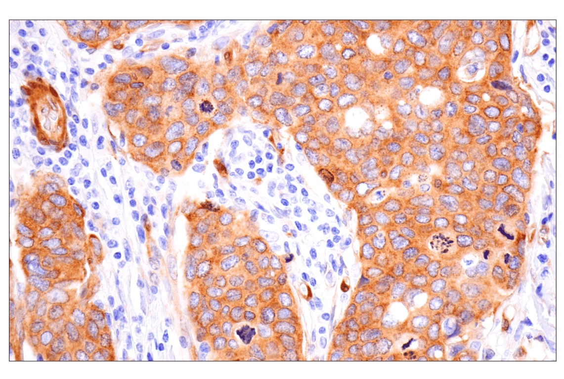 FAK (F7Z4C) Mouse mAb (BSA and Azide Free) | Cell Signaling