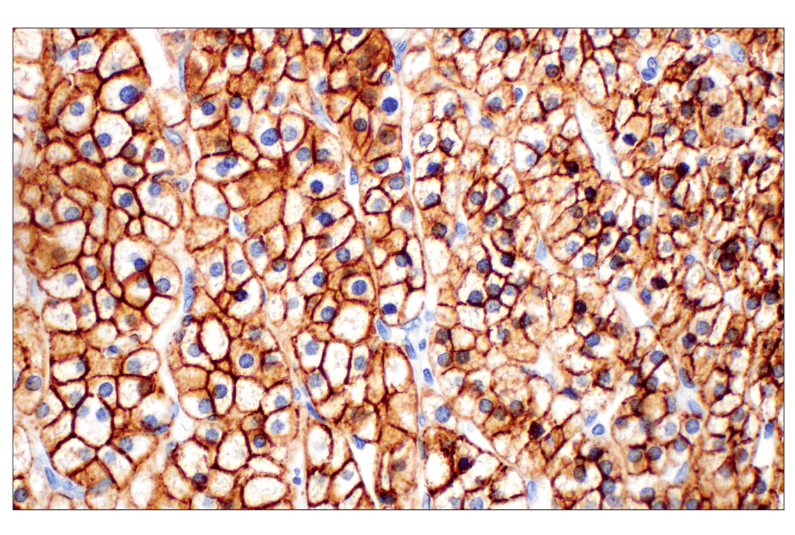 Immunohistochemistry Image 3: SCARB1 (E9H4F) Rabbit Monoclonal Antibody