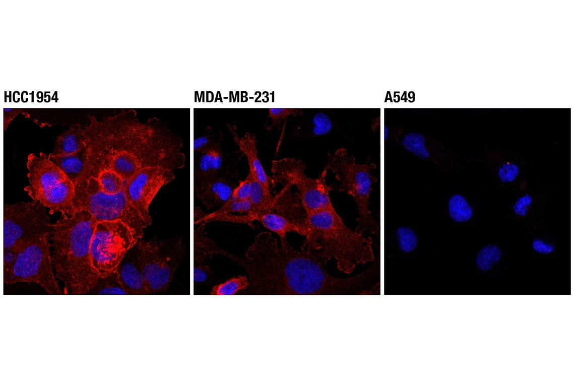 Immunofluorescence Image 1: PD-L1 (Extracellular Domain Specific) (D8T4X) Rabbit mAb (Alexa Fluor<sup>®</sup> 555 Conjugate)