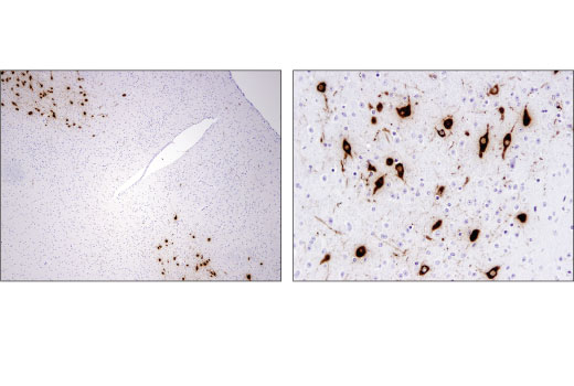 Immunohistochemistry Image 2: Orexin (D6G9T) Rabbit Monoclonal Antibody