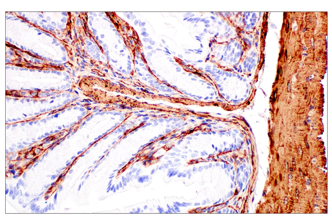 Immunohistochemistry Image 11: Filamin A (E8P8M) Rabbit Monoclonal Antibody