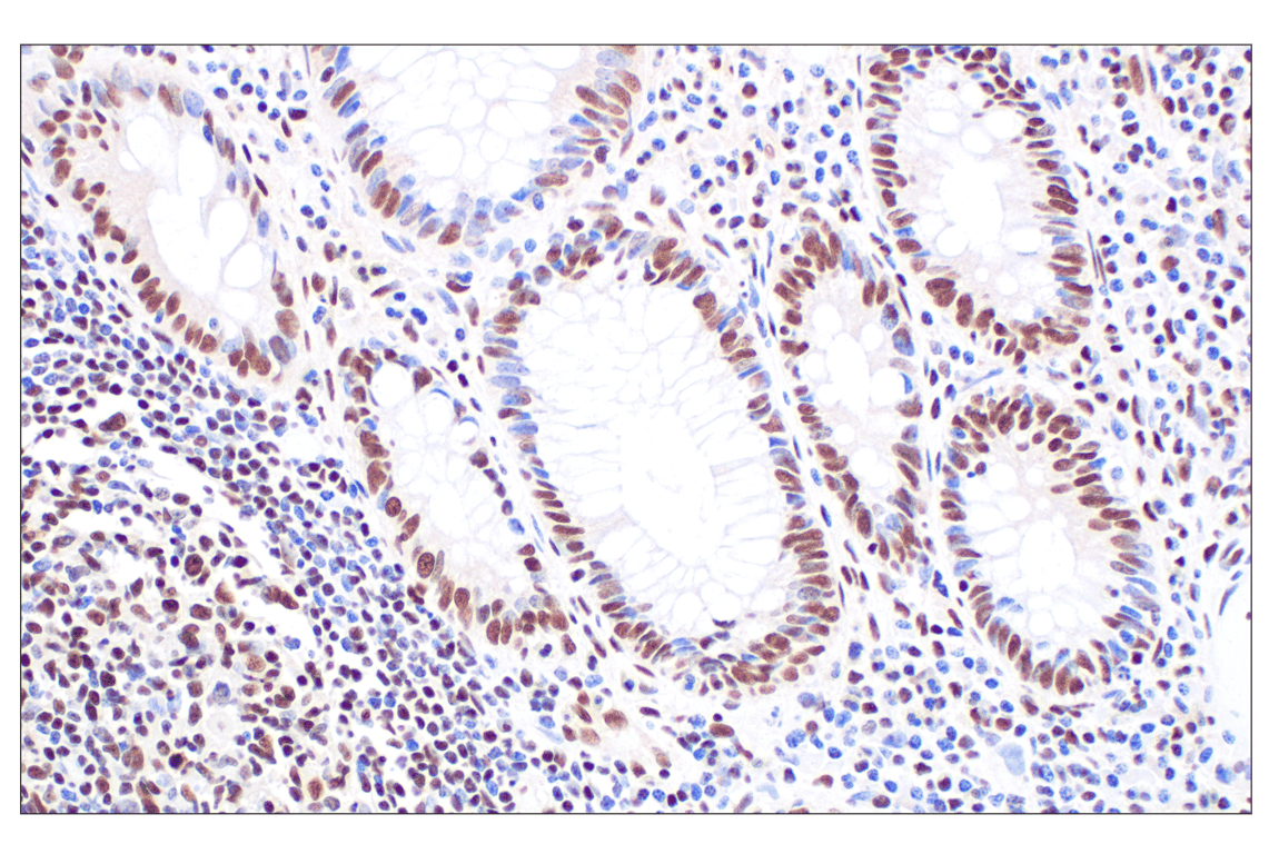 undefined Image 17: PPAR gamma Regulated Fatty Acid Metabolism Antibody Sampler Kit